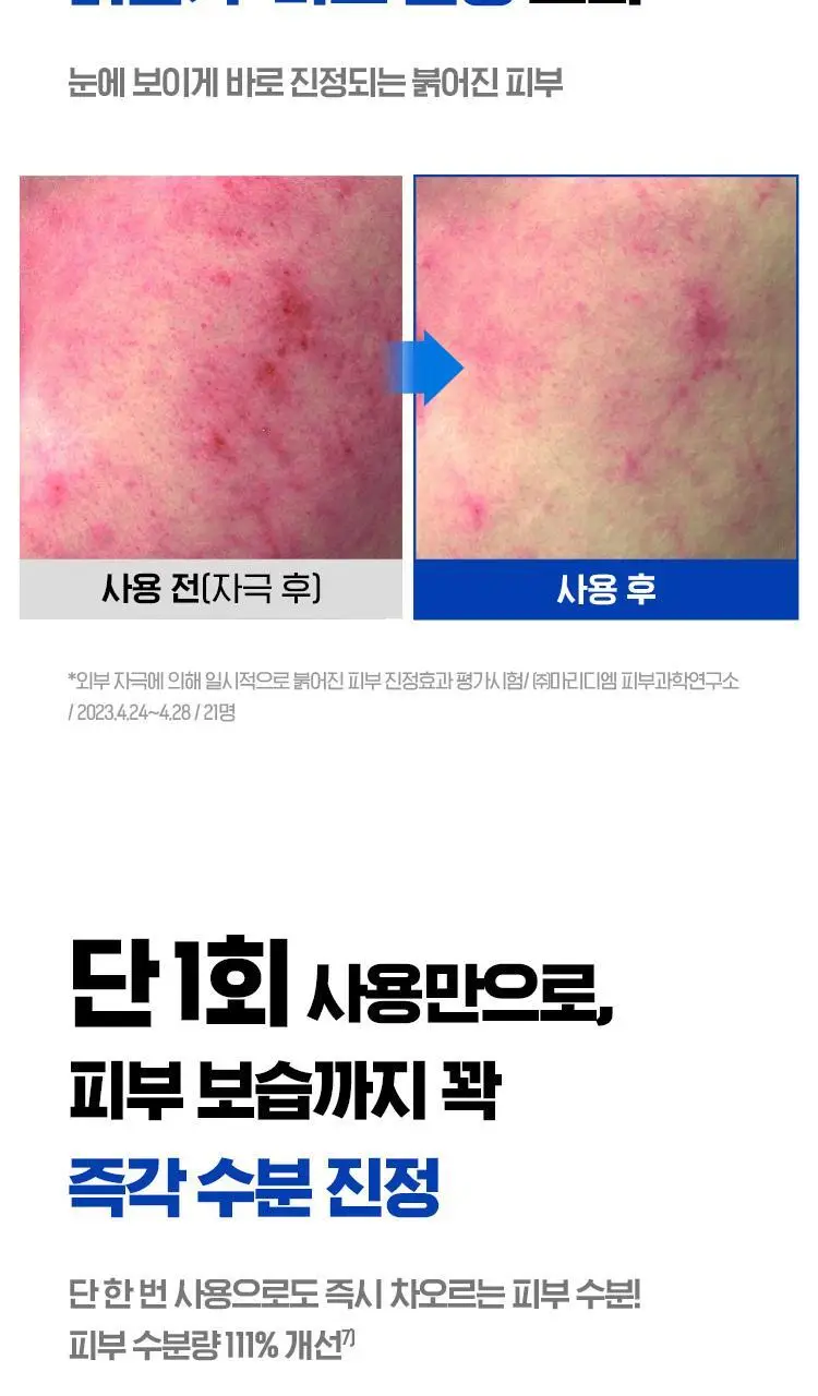 [응급진정세럼] 아이소이 아크니닥터 1st 컨트롤 세럼 40ml 기획(+응급진정패드4매) 상세페이지 9